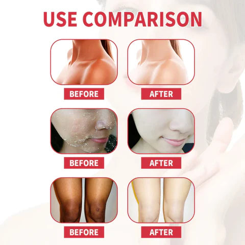 Peach Glow Exfoliating Face Gel™
