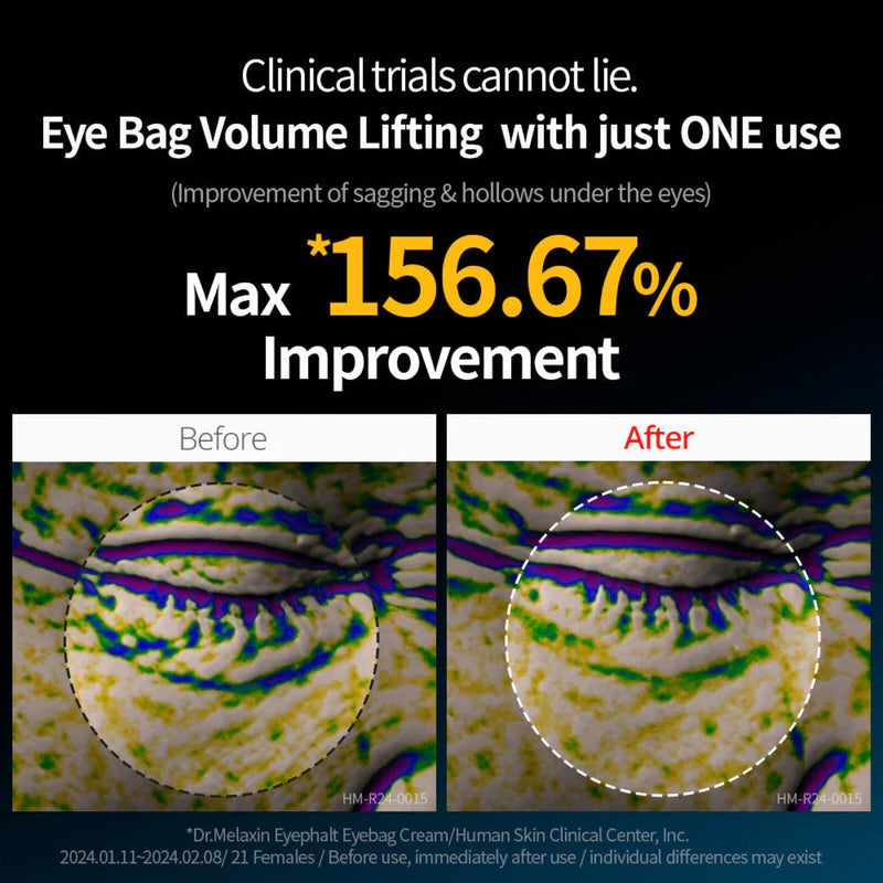 Dr. Melaxin™ Eyephalt Eye Cream For Dark Circles & Puffy Eyes