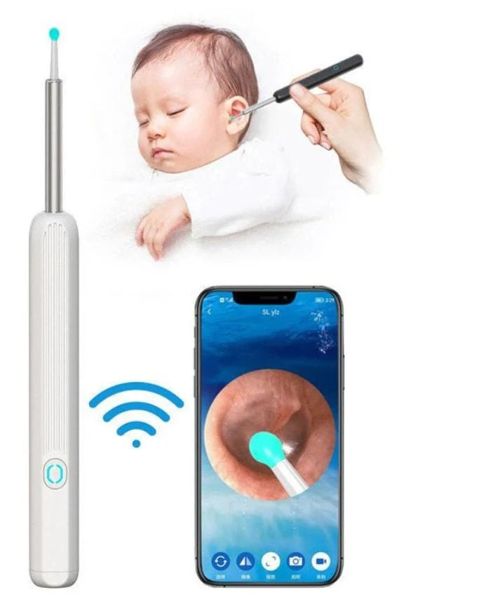 مجموعة إزالة شمع الأذن Smart Ear Cleaner™